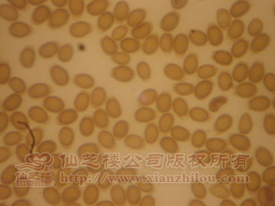游动孢子囊显微镜图片图片